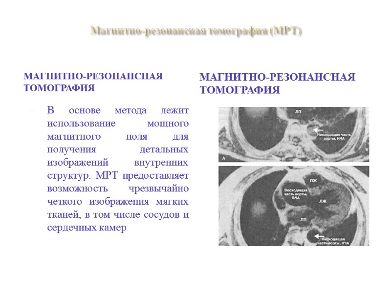 Магнитно-резонансная томография (МРТ)  Магнитно-резонансная томография Магнитно-резонансная томография В основе метода лежит использование мощного